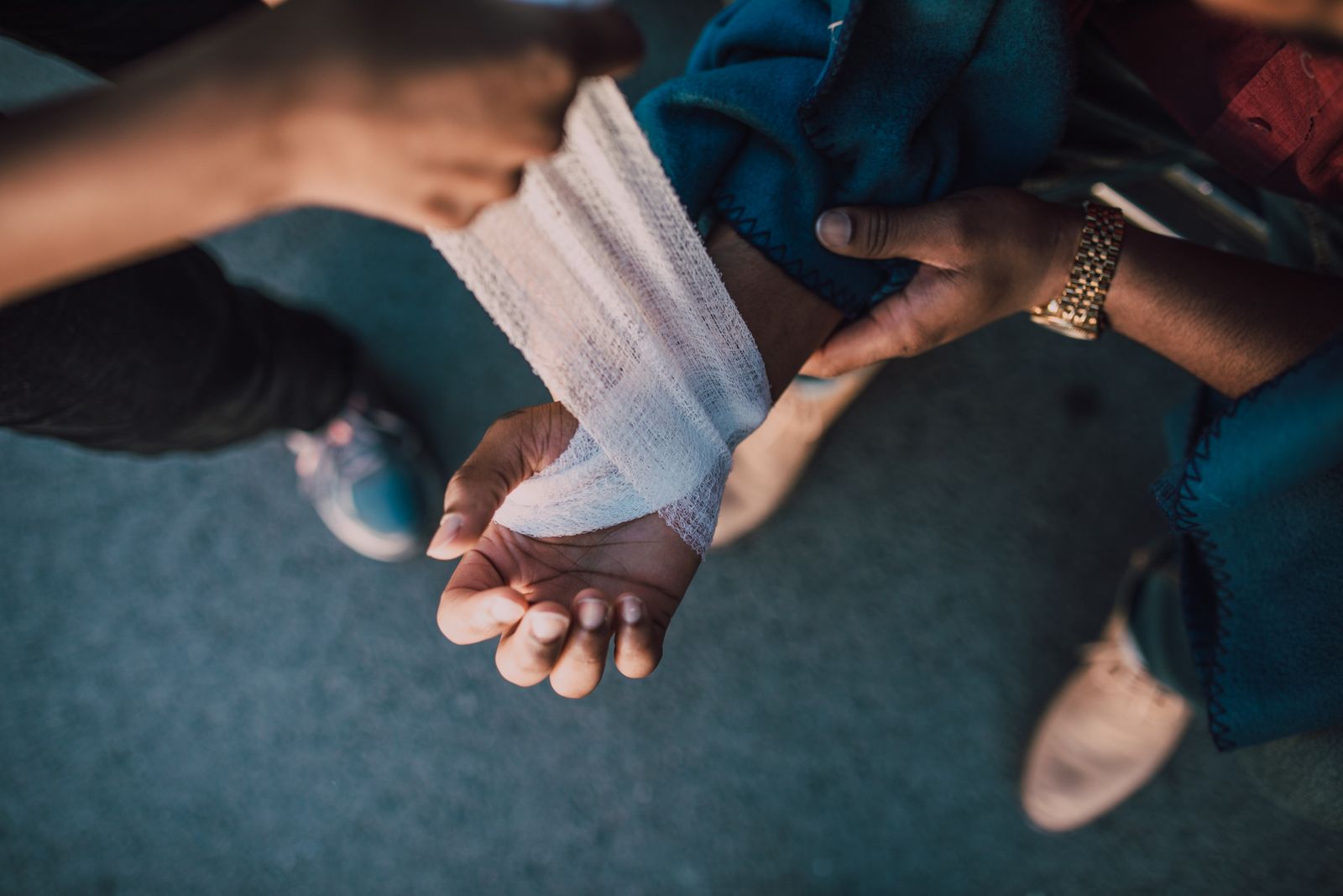 What Is a Degloving Hand Injury and How Serious Is It